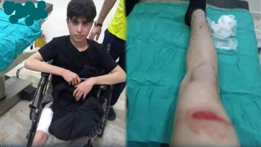 Kesên rûpûskirî li Efrînê zarokê 16 salî kêr kirin