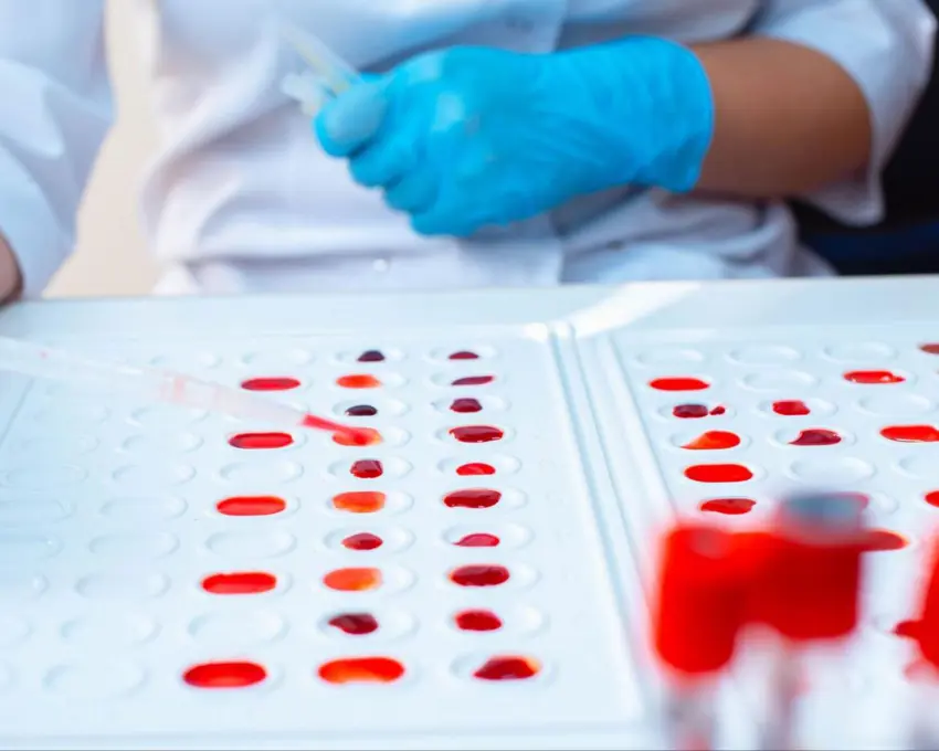 بەم زووانە دەتوانرێت بە یەک دڵۆپ خوێن سێ جۆری مەترسیداری شێرپەنجە دەستنیشان بکرێت