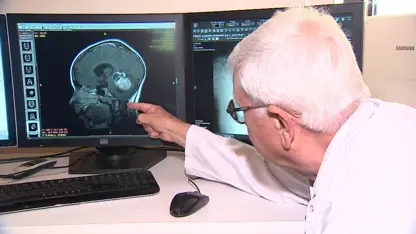 Arastirma: Zenginlerde kanser riski, fakirlere göre daha yüksek