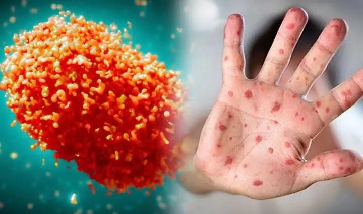 Avrupa'da M çiçegi uyarisi!