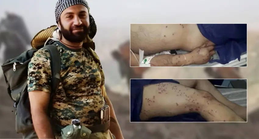 Kolberekî Kurd li sînorê Selvayê bi guleyên hêzên Rejîma Îranê birîndar bû