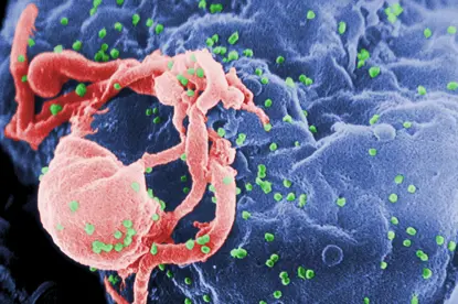 وهزارهتی تهندرووستی حكوومهتی ههرێم : سێ حاڵهتی ههڵگری ڤایرۆسی HIV دهستنیشان كران