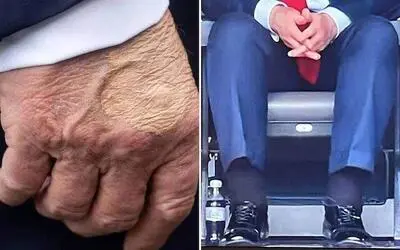 كۆشكی سپی : تەندرووستی دۆناڵد ترامپ زۆر باشە