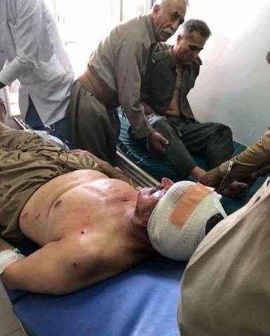 Sekreterê HDKê jî di encama êrîsê de birîndar bû