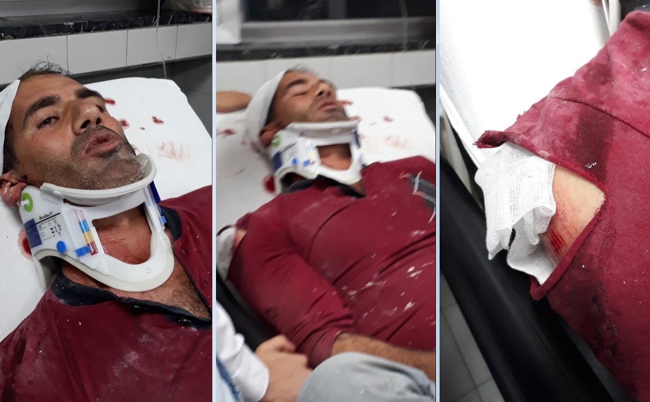 Ankara’da, “Kürtsünüz sizi burada istemiyoruz” dedikleri isçiyi 5. kattan attilar!