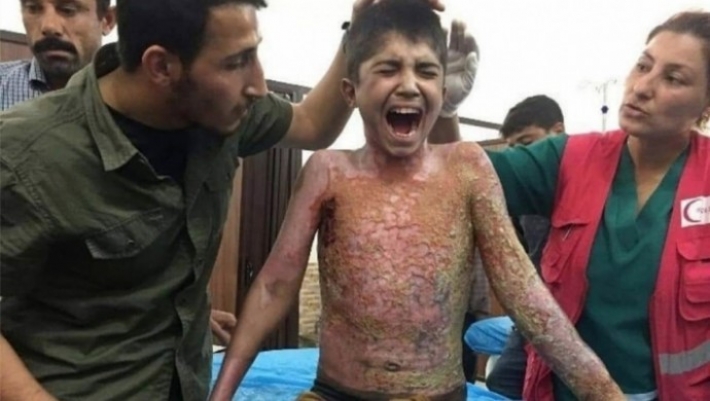 ABD kongre üyesi: Türkiye’nin Rojava’da Beyaz fosfor kullanimi arastirilsin