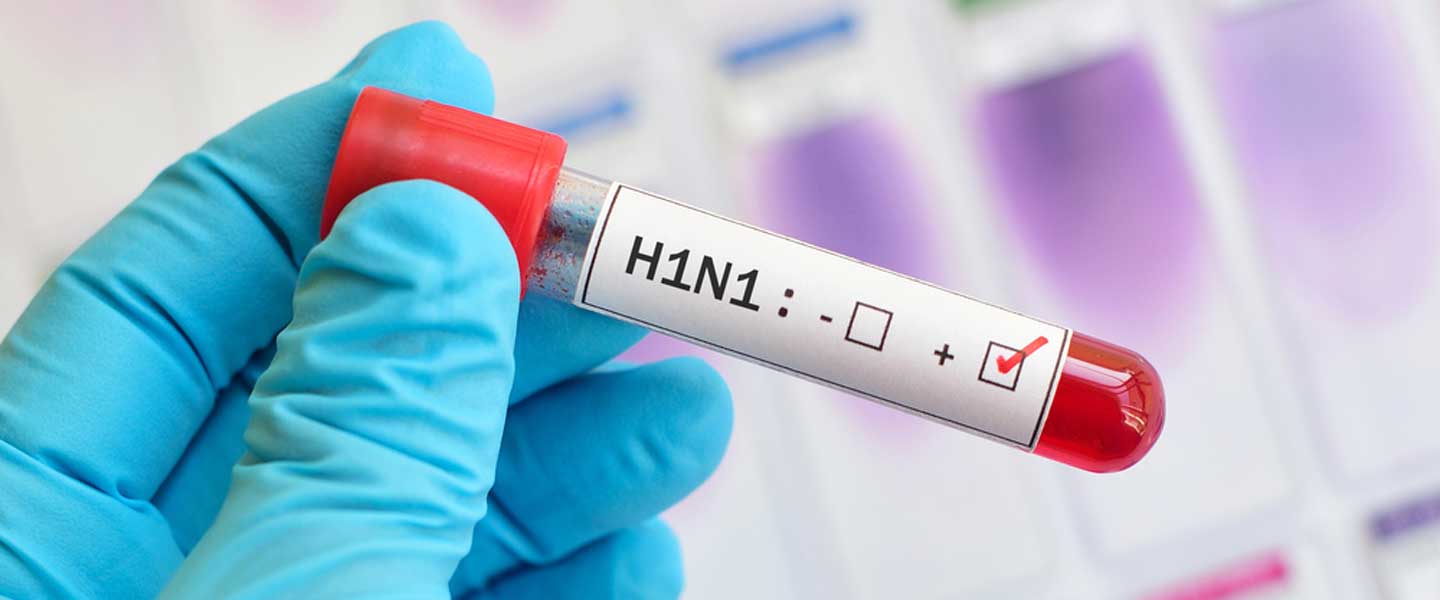 Wezîrê Tendirûstiyê Berzincî: Ji ber sewba berazan 3 kesan canê xwe ji dest da