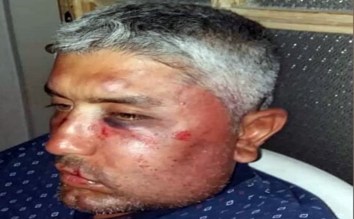 Li Efrînê Kurdekî din bi tundî hat îskence kirin