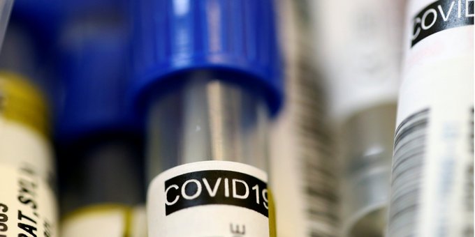 Nûneratiya Herêma Kurdistanê: 7 Kurd li Amerîkayê bi koronayê ketine