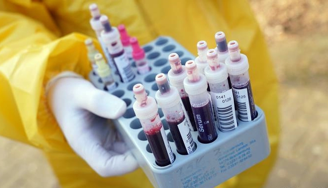 Almanya dest bi testên xweragiriya li hemberî vîrusa corona dike