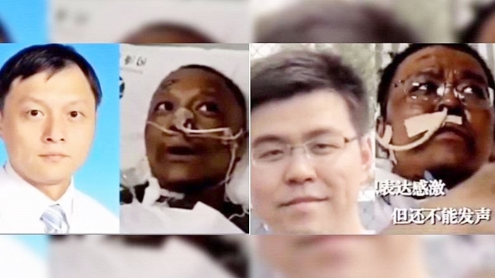 Rengê lasê doktorên Çînî pistî pêketina vîrusê res bû