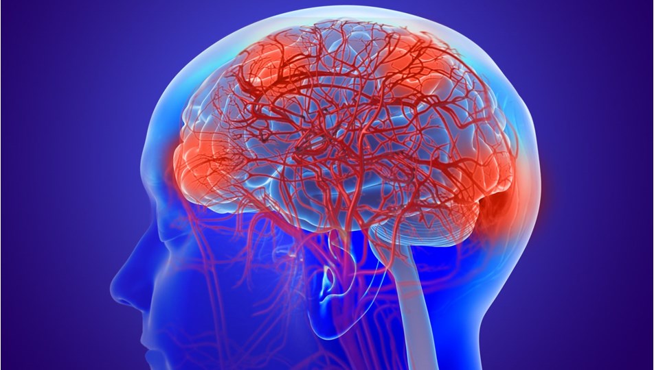 Cûreyeke nû ya nexwesiya mejî li Kanadayê hat dîtin