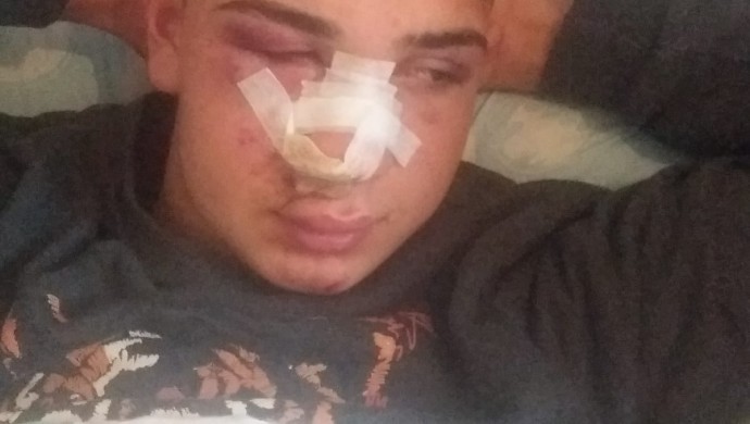 Li Enqerê bi dirusmên nijadperestî êrîsî ciwanekî Kurd ê 17 salî kirin