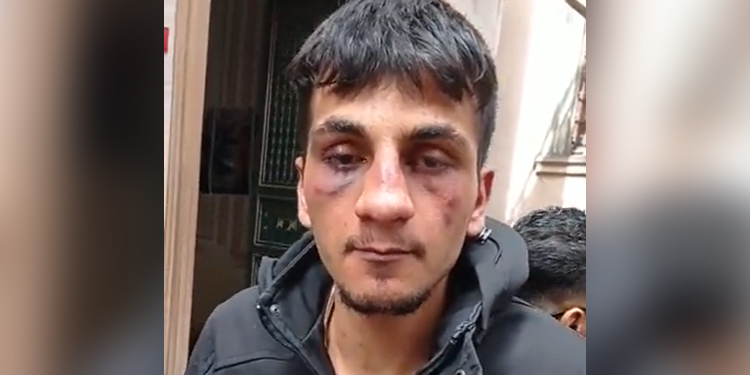 Polîsên Tirkiyê li Stenbolê êrîsî zarokek û ciwanekî Kurd kirin