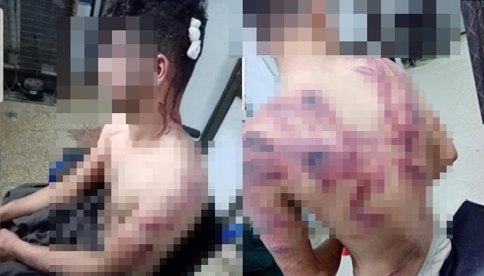 Rojava | 3 zarokên dixwestin sînor derbas bikin rastî îskenceya giran a leskerên Tirk hatin