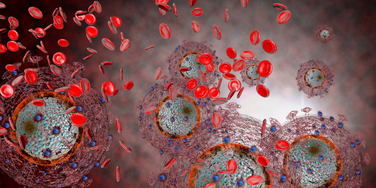 Wezareta Tendirustiyê: 72 haletên nû yên pêketina bi HIV/AIDSê li Herêma Kurdistanê hatine tomarkirin