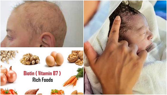 Kêmbûna enzîma biyotîdînazê