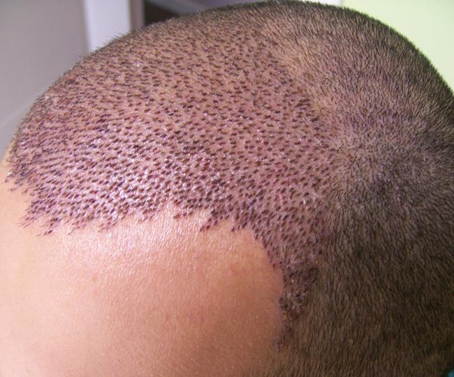 Çandina pora mirovan bû sektorekî û ji 1 mîlyar dolarî derbas bû