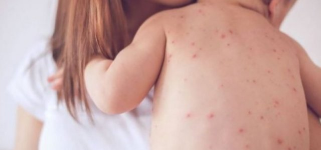 Li Zelanda Nû nexwesîna sorikan her diçe zêde dibe