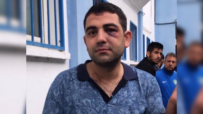 Istanbul’da Amedspor’a irkçi saldiri