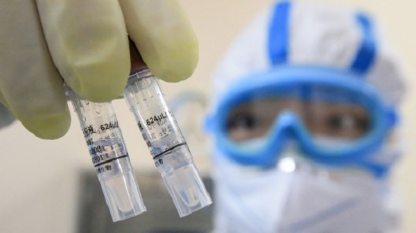 ‘O ülke’ 15 dakikada sonuçlanan test gelistirdi