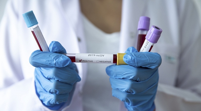 Kürdistan Bölgesi'nde vaka sayisi 20’ye çikti