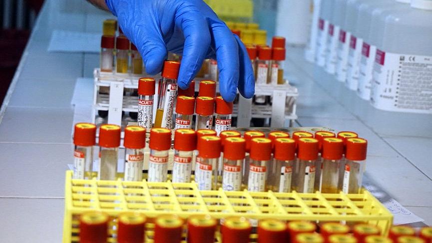 Ingiltere’den 20 dakikalik sonuç veren antikor testi