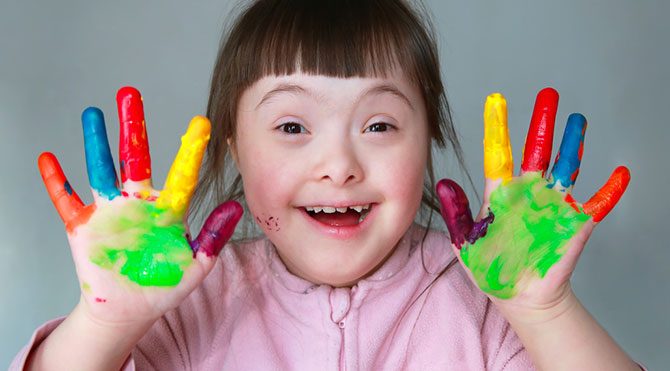 Down Sendromu Otizm ile Down sendromu nasil ayirt edilir