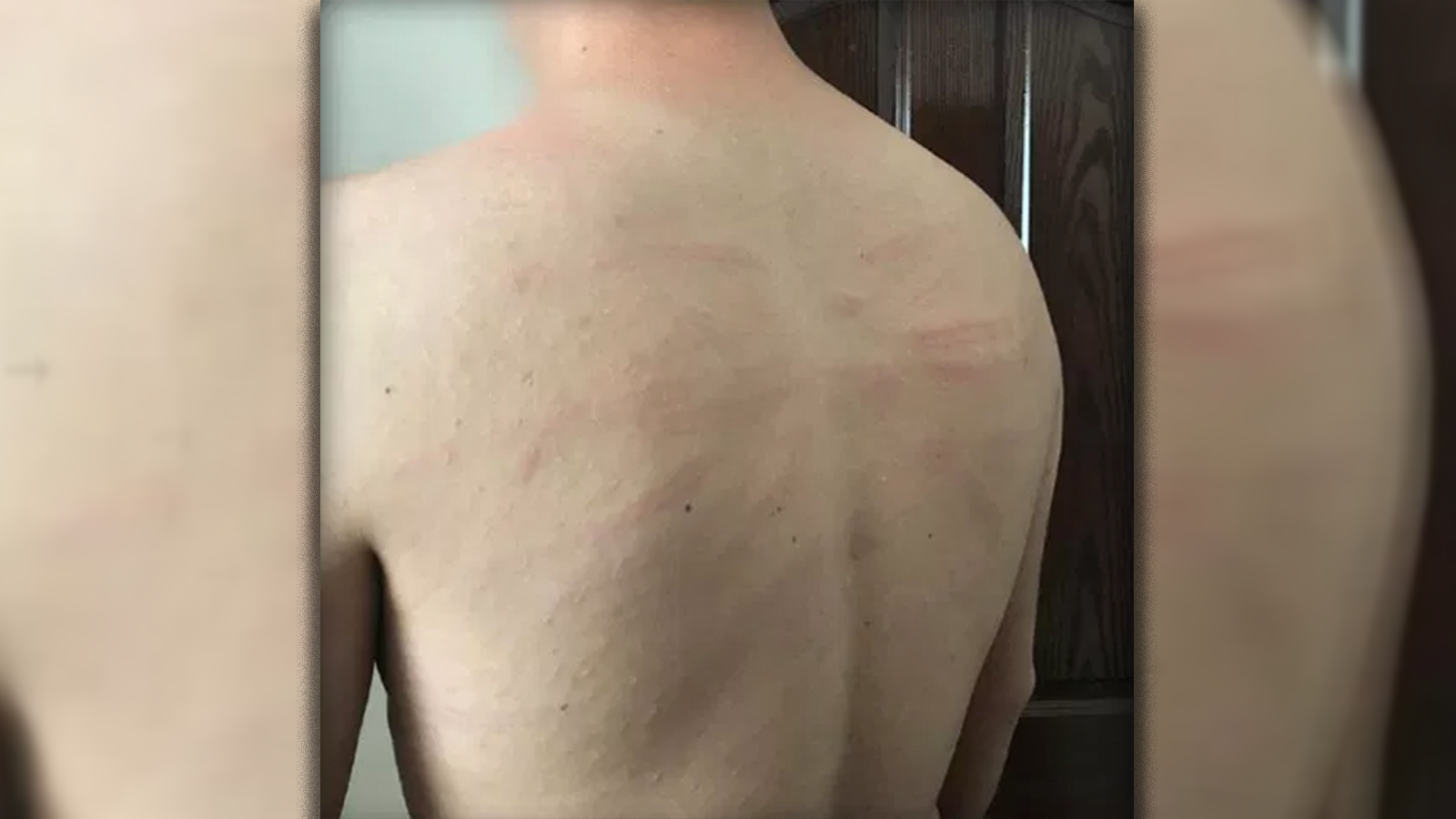 ‘Pis Kürt’ deyip iskence yaptilar”