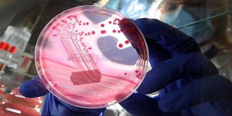 كەسێكی دیكە لە کوردستان بە تای خوێنبەربوون گیانی لەدەستدا