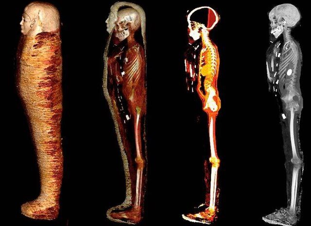 دۆزینەوەی زێڕ و گەوهەر لە کوڕێکی مۆمیایی کراو