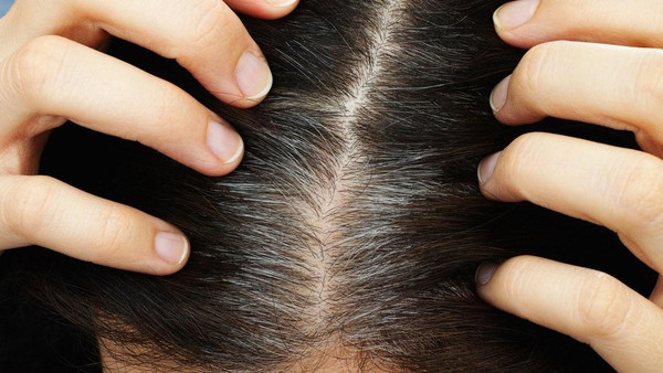 بە توێکڵی پەتاتە خۆت لە پیربوون بپارێزە