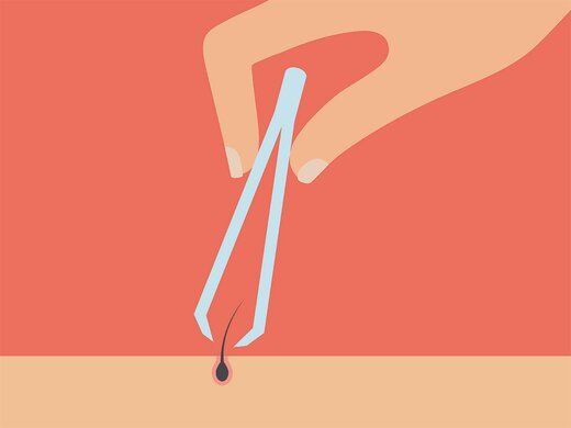 سێ تێڕوانینی هەڵە سەبارەت بە مووی زیادە