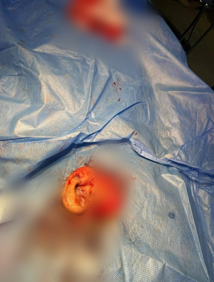 سلێمانی/ گوێدرێژێک بە قەپ گوچێکەی منداڵێکی لێکردەوە