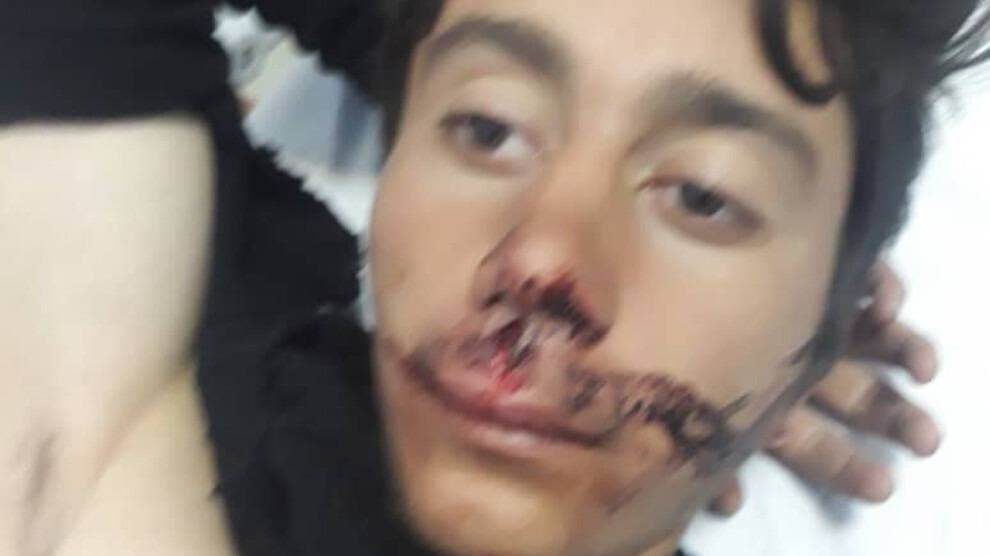 دوو کۆڵبەری ڕۆژهەڵاتی بە دەستی هێزەکانی لەشکەری تورکیا کوژران و بریندار بوون