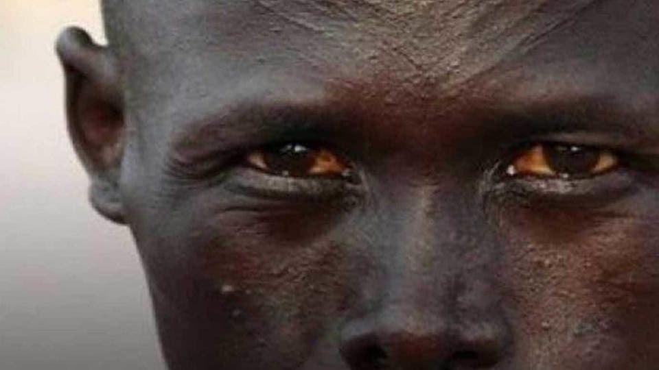 بەپەلە    ...    چەندین هەزار کەس لە ئێتیوپیا بە ڤیرووسێکی نەناسراو کوژران