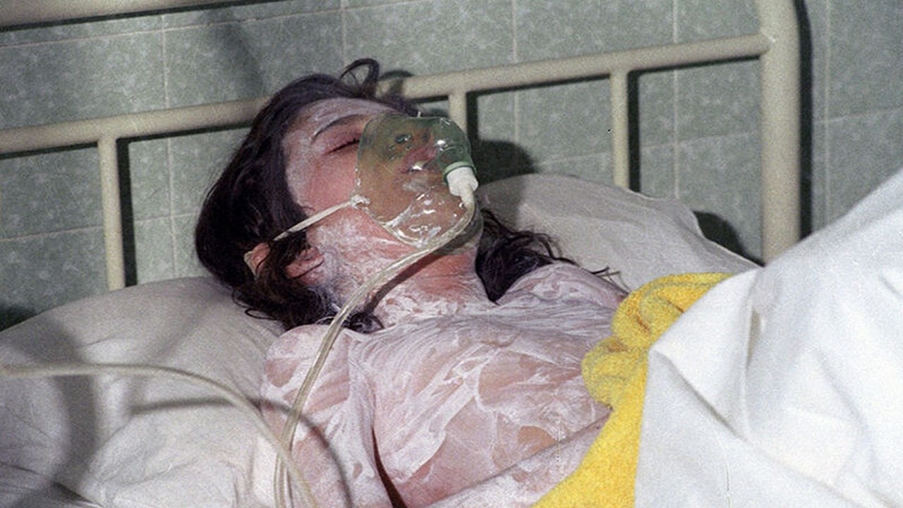 دوای تێپەڕینی ٣٥ ساڵ لە کیمیابارانی "سەردەشت"، هێشتا بریندارەکانی لە نەبوونی خزمەتگوزاری دەناڵێنن