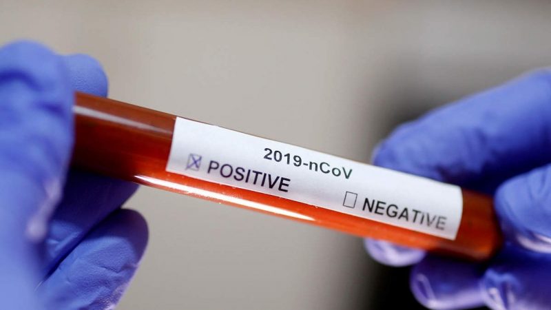 هوشداری وەزارەتی تەندروستی لە بارەی جۆرە نوێیەکەی کۆرۆنا