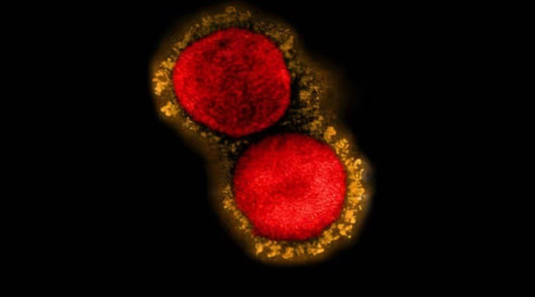 هۆشداری ڕێکخراوی تەندرووستی جیهانی : پیاوێک لە ئیمارات تووشی ڤایرۆسی MERS-CoV بووە