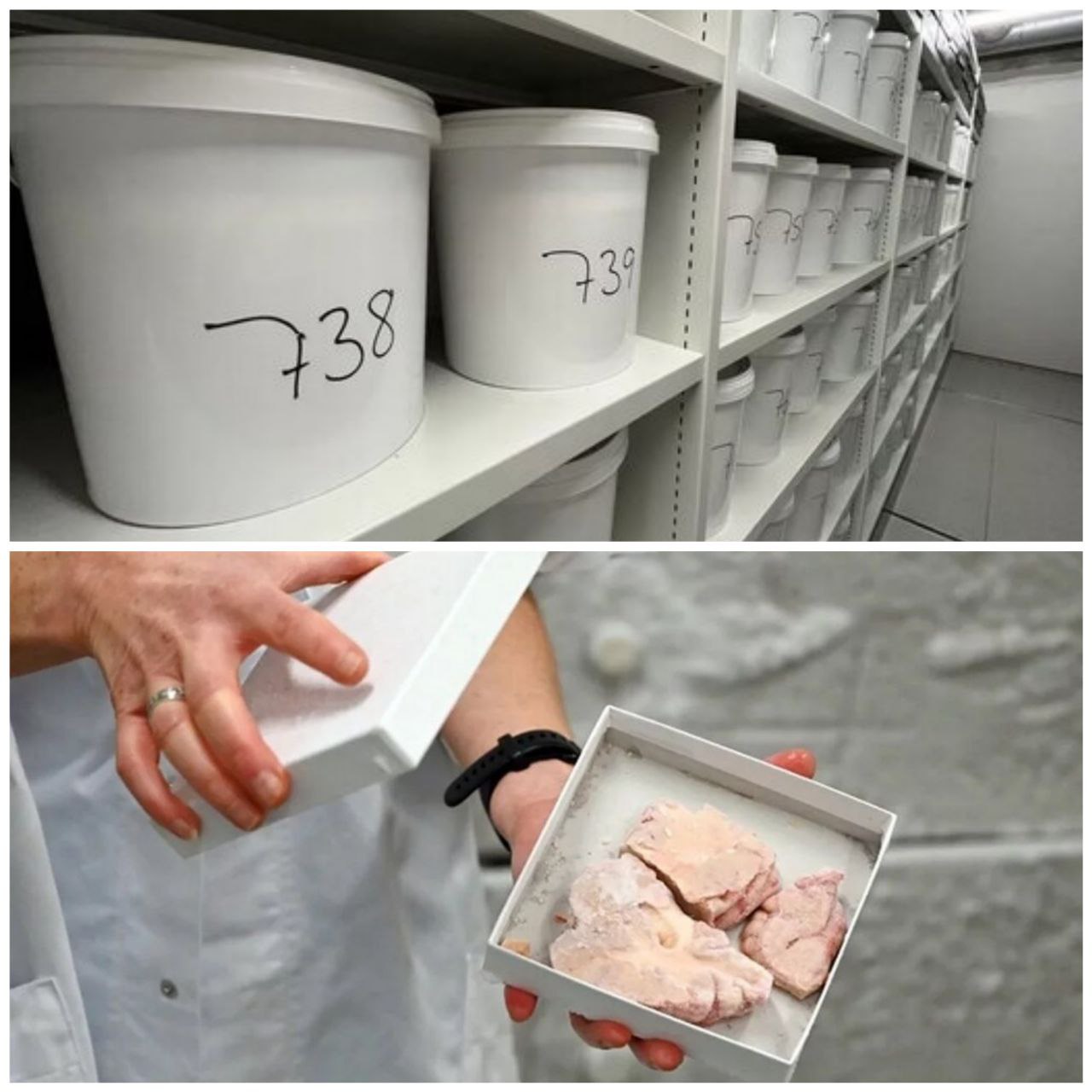 گەورەترین کۆمەڵەی مێشک لە جیهان / لێرەدا مێشکی مرۆڤەکان لە سەتڵێکدا دادەنێن