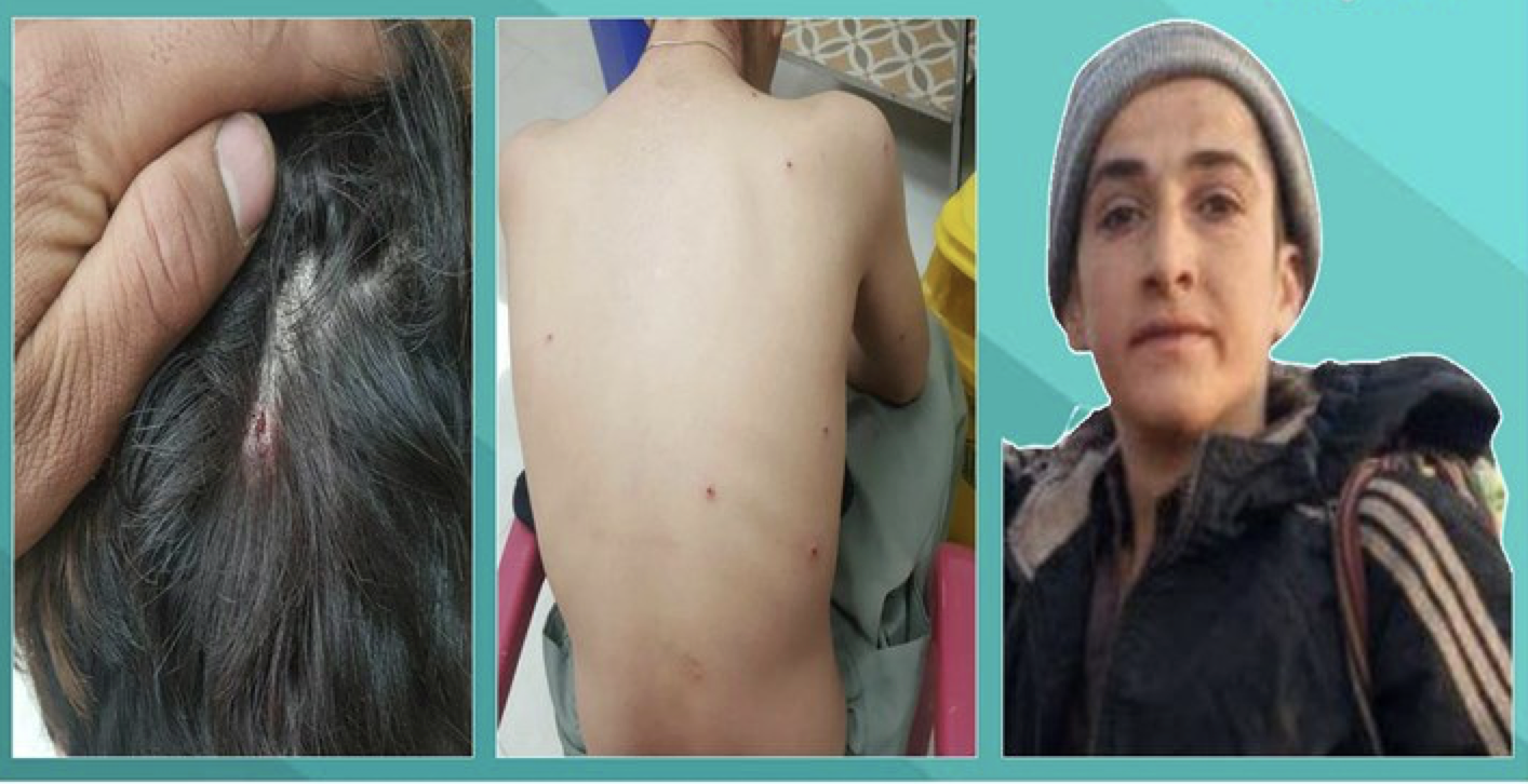 لە سنووری کرماشان کۆڵبەرێک بریندار کرا