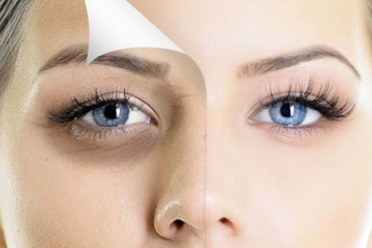 ٥ شت کە یارمەتی گەشانەوەی پێست دەدەن