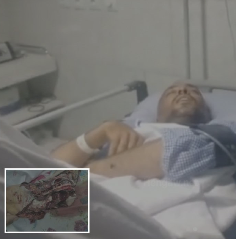 کۆڵبەرێک بە هۆی تەقینەوەی مین بە سەختی بریندار بوو