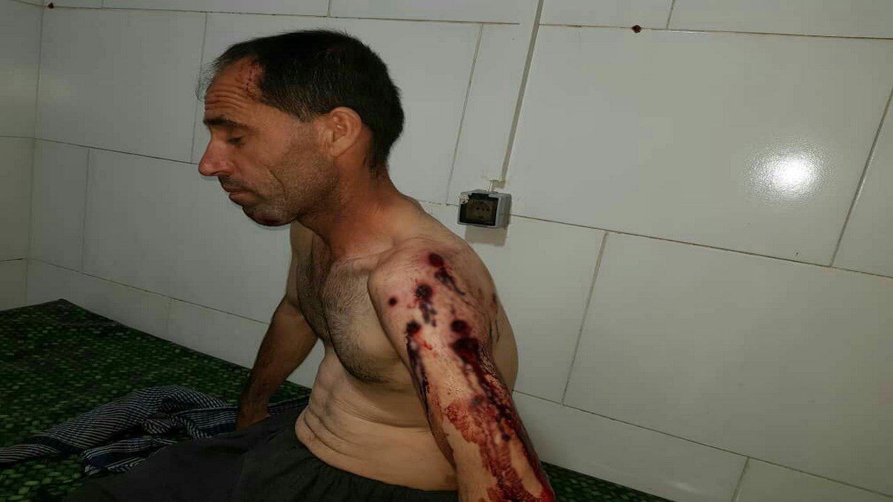 کۆڵبەرێکی کورد لە سنووری کرماشان بریندار کرا