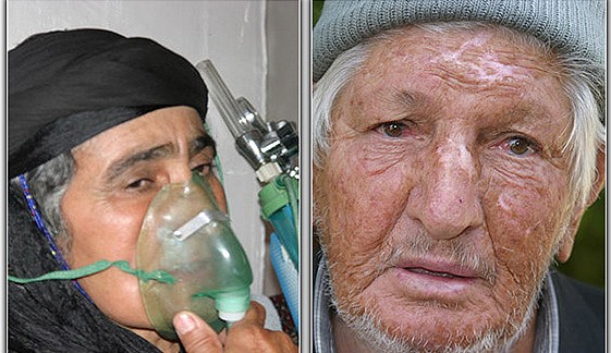 ٣٣ ساڵ بەرلەئێستا گوندی زەردە سەر بە پارێزگای کرماشان لە ناوچەی دالاهۆ لە لایەن ڕژیمی بەعث ەوە کیمیاباران کرا