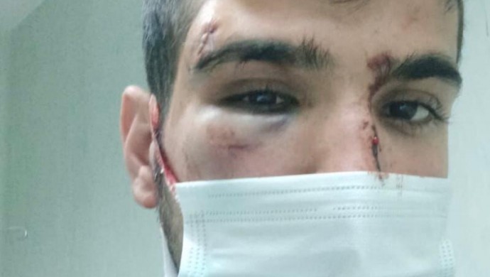 لە زانکۆیەکی تورکیا هێرش کرایە سەر سێ خوێندکاری کورد