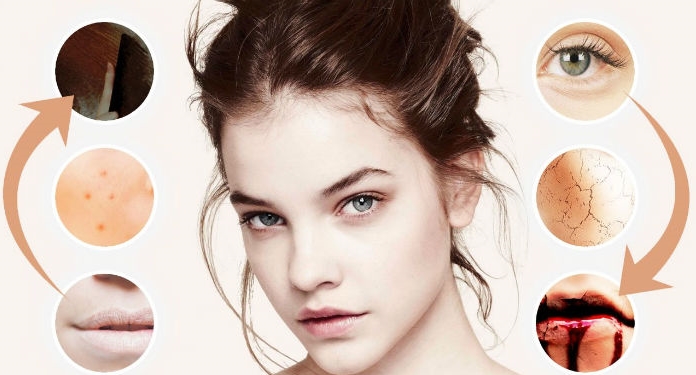 نیشانەکانی هەندێک کەمی ڤیتامین لە دەم و چاودا