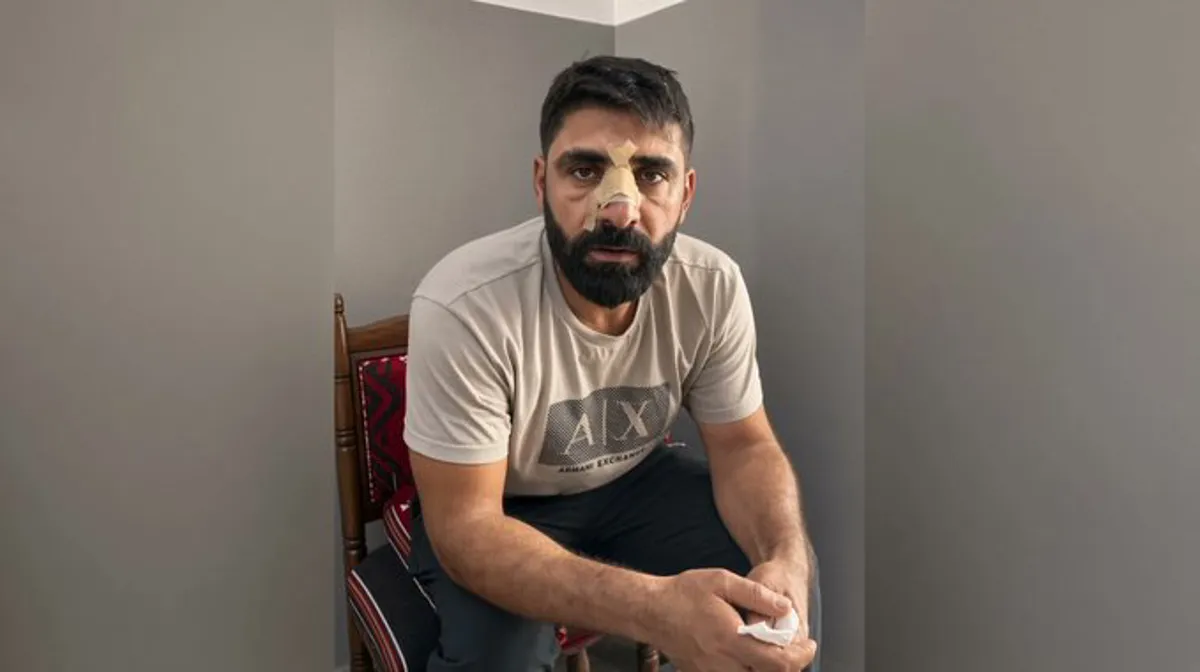 Li Bayburtê êrişî karkerên Kurd kirin